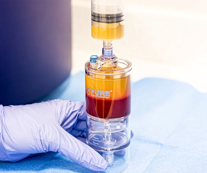 Emcyte PurePRP SupraPhysiologic 60 mL